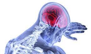 عوامل غیرقابل کنترل به وجود آورنده سکته مغزی -وبسایت دکتر زکوی